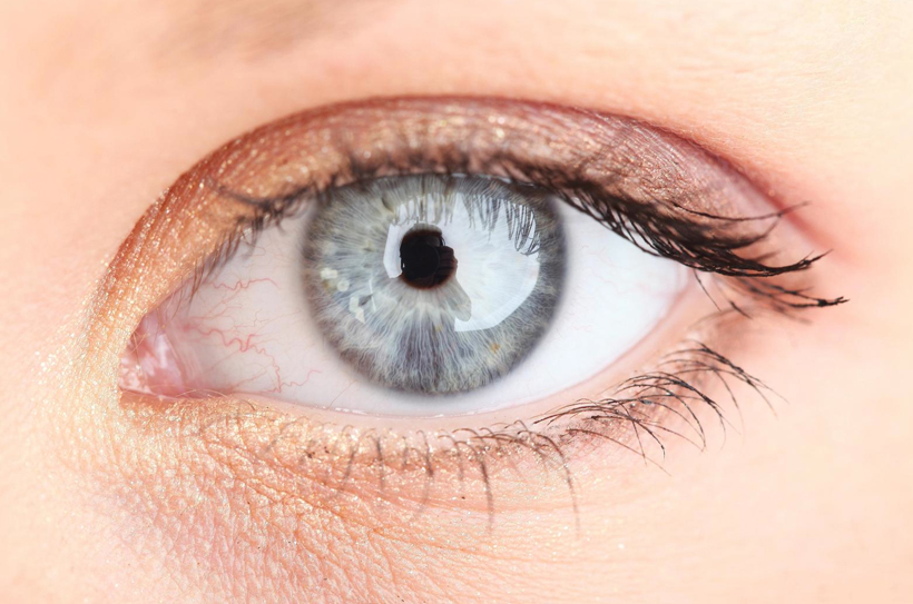 5 réponses sur les lentilles de contact